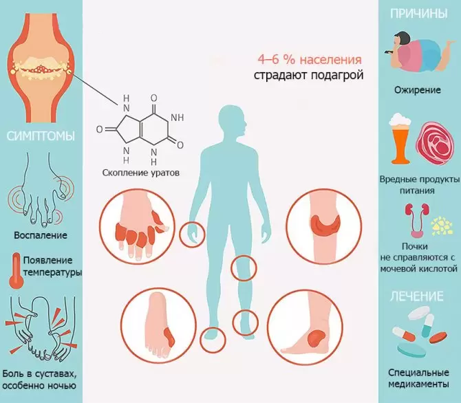 Диета при подагре Диета при подагре