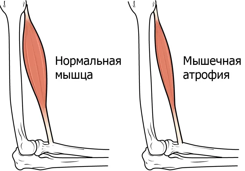 Сохранить мышцы с возрастом Сохранить мышцы с возрастом