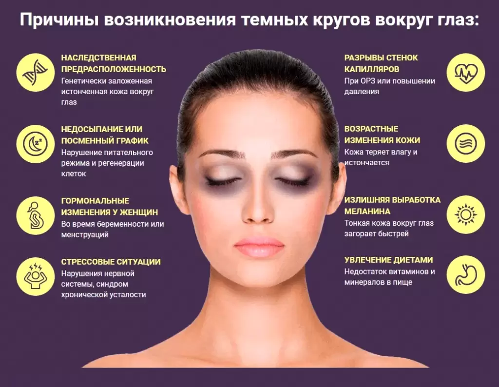 Причины темных кругов под глазами у женщин и мужчин Причины темных кругов под глазами у женщин и мужчин