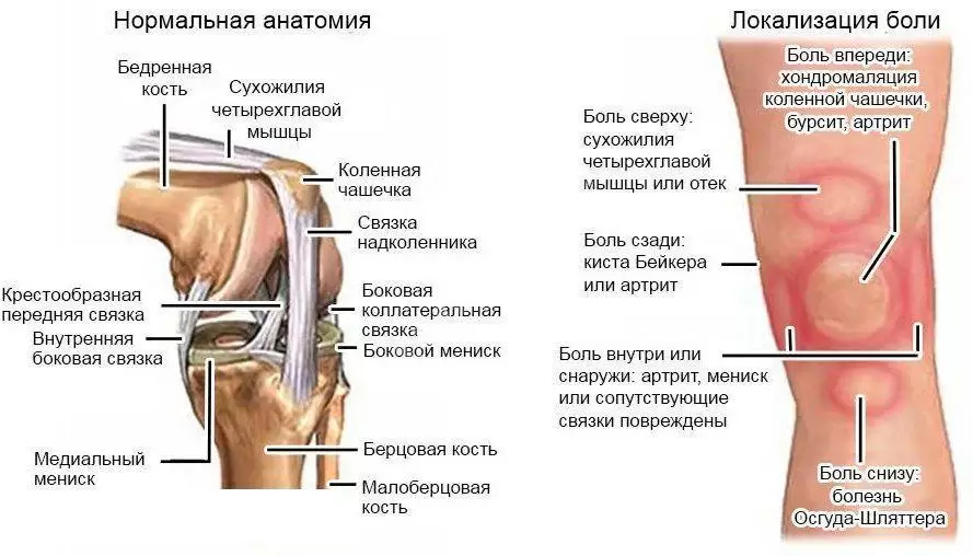 Что делать если болят колени после тренировки Что делать если болят колени после тренировки