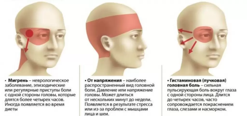 Лечение головной боли после тренировки Лечение головной боли после тренировки