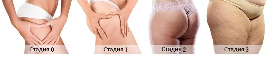 5e796cd561e9fb5154e1d4d3deff8f77.png 5e796cd561e9fb5154e1d4d3deff8f77.png